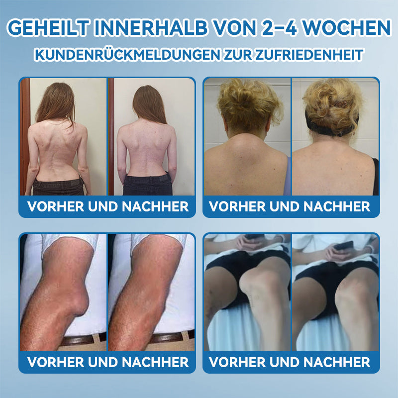 🔥Kaufe 2 für nur 23.97 € ✨Am meisten gewählt✨