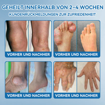 【Nur noch 30 MINUTEN – Aktion endet bald!⏰⏰】