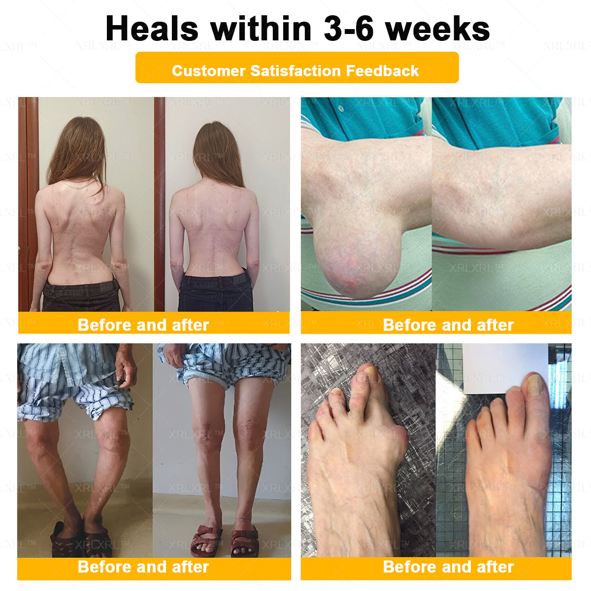 🎄🎄XRLXRL® Bee Venom Pain-Relief Bone Healing Cream (Specially for older adults)