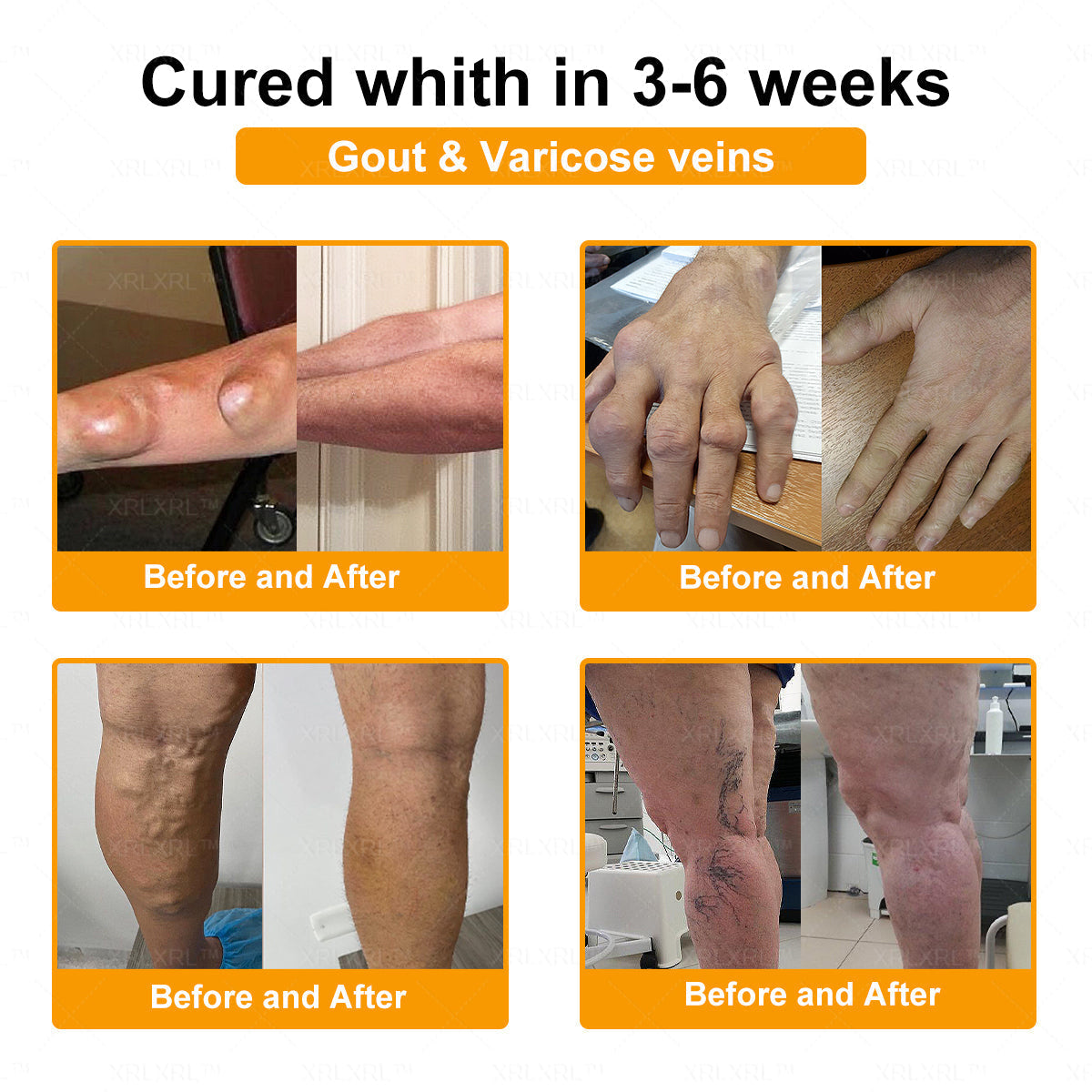 🎄🎄XRLXRL® Bee Venom Pain-Relief Bone Healing Cream (Specially for older adults)