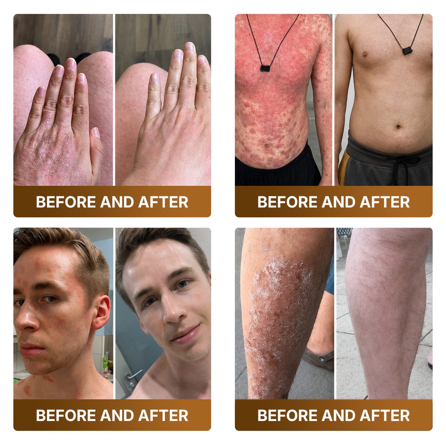 👑Made and Shipped from US ✨🔥 DOCTIA® Botox & Bee Venom Advanced Recovery Cream—For Wrinkles, Sagging Skin, Skin Tags & Rough Bumps
