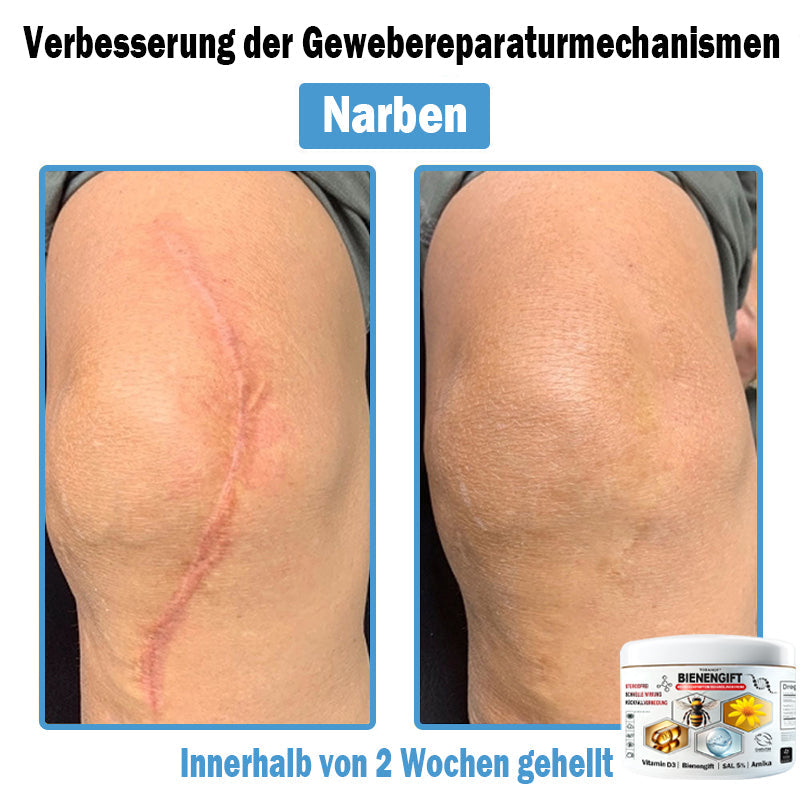 𝐇𝐮𝐝𝐫𝐨𝐬®🥥🏆 𝑩𝒊𝒆𝒏𝒆𝒏 𝑮𝒊𝒇𝒕 𝑴𝒖𝒍𝒕𝒊𝒔𝒚𝒎𝒑𝒕𝒐𝒎 𝑩𝒆𝒉𝒂𝒏𝒅𝒍𝒖𝒏𝒈𝒔𝒄𝒓𝒆𝒎𝒆 (𝐨𝐟𝐟𝐢𝐳𝐢𝐞𝐥𝐥 𝐳𝐞𝐫𝐭𝐢𝐟𝐢𝐳𝐢𝐞𝐫𝐭)