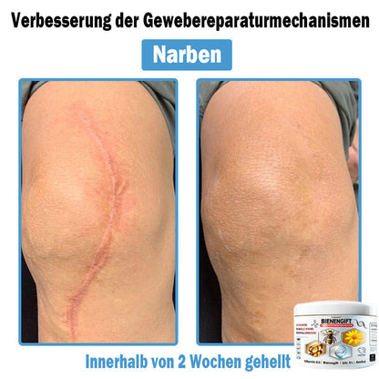 𝐇𝐮𝐝𝐫𝐨𝐬®🥥🏆 𝑩𝒊𝒆𝒏𝒆𝒏 𝑮𝒊𝒇𝒕 𝑴𝒖𝒍𝒕𝒊𝒔𝒚𝒎𝒑𝒕𝒐𝒎 𝑩𝒆𝒉𝒂𝒏𝒅𝒍𝒖𝒏𝒈𝒔𝒄𝒓𝒆𝒎𝒆 (𝐨𝐟𝐟𝐢𝐳𝐢𝐞𝐥𝐥 𝐳𝐞𝐫𝐭𝐢𝐟𝐢𝐳𝐢𝐞𝐫𝐭)