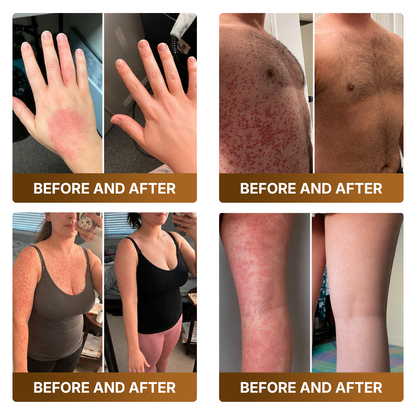 👑Made and Shipped from US ✨🔥 DOCTIA® Botox & Bee Venom Advanced Recovery Cream—For Wrinkles, Sagging Skin, Skin Tags & Rough Bumps