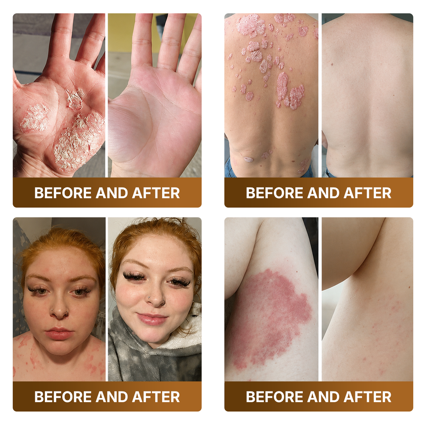 👑Made and Shipped from US ✨🔥 DOCTIA® Botox & Bee Venom Advanced Recovery Cream—For Wrinkles, Sagging Skin, Skin Tags & Rough Bumps