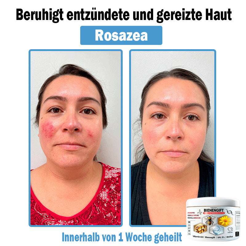 3 Dosen📦Kostenloser Versand - 40.97 €