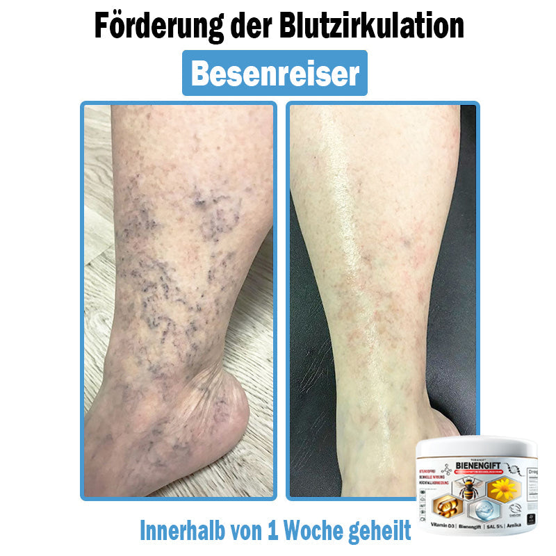 𝐇𝐮𝐝𝐫𝐨𝐬®🥥🏆 𝑩𝒊𝒆𝒏𝒆𝒏 𝑮𝒊𝒇𝒕 𝑴𝒖𝒍𝒕𝒊𝒔𝒚𝒎𝒑𝒕𝒐𝒎 𝑩𝒆𝒉𝒂𝒏𝒅𝒍𝒖𝒏𝒈𝒔𝒄𝒓𝒆𝒎𝒆 (𝐨𝐟𝐟𝐢𝐳𝐢𝐞𝐥𝐥 𝐳𝐞𝐫𝐭𝐢𝐟𝐢𝐳𝐢𝐞𝐫𝐭)