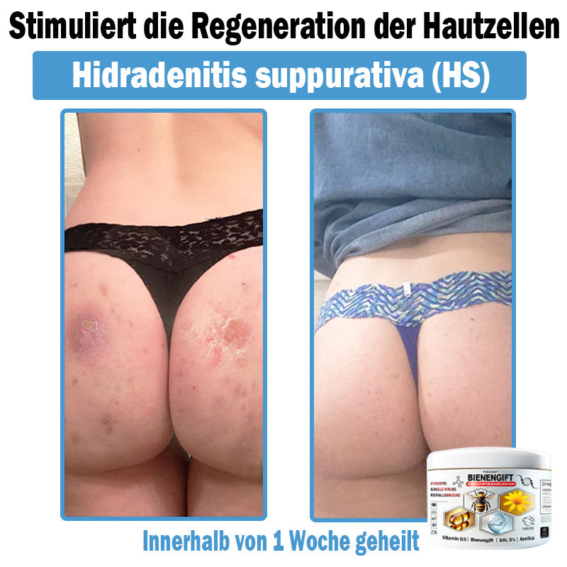 4 Dosen🔥Komplette Heilung - 49.97 €