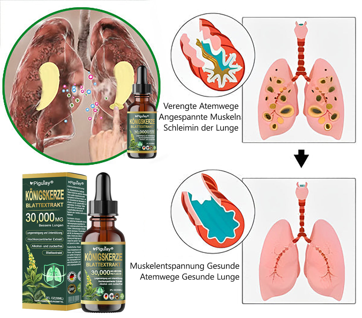 𝗢𝗳𝗳𝗶𝘇𝗶𝗲𝗹𝗹 | 𝗣𝗶𝗴𝘂𝗶𝗮𝘆® 𝗕𝗶𝗼-𝗟𝘂𝗻𝗴𝗲𝗻𝗿𝗲𝗶𝗻𝗶𝗴𝘂𝗻𝗴𝘀-𝗧𝗿𝗼𝗽𝗳𝗲𝗻 𝗮𝘂𝘀 𝗞𝗼̈𝗻𝗶𝗴𝘀𝗸𝗲𝗿𝘇𝗲𝗻𝗯𝗹𝗮𝘁𝘁-𝗘𝘅𝘁𝗿𝗮𝗸𝘁 🎁𝐊𝐥𝐢𝐧𝐢𝐬𝐜𝐡 𝐛𝐞𝐬𝐭𝐚̈𝐭𝐢𝐠𝐭 – 𝐡𝐨𝐜𝐡𝐤𝐨𝐧𝐳𝐞𝐧𝐭𝐫𝐢𝐞𝐫𝐭𝐞 𝐅𝐨𝐫𝐦𝐞𝐥 𝐳𝐮𝐫 𝐋𝐢𝐧𝐝𝐞𝐫𝐮𝐧𝐠 𝐯𝐨𝐧 𝐇𝐮𝐬𝐭𝐞𝐧, 𝐒𝐜𝐡𝐥𝐞𝐢𝐦, 𝐀𝐬𝐭𝐡𝐦𝐚 𝐮𝐧𝐝 𝐂𝐎𝐏𝐃. 𝐅𝐮̈𝐫 𝐟𝐫𝐞𝐢𝐞𝐫𝐞𝐬, 𝐥𝐞𝐢𝐜𝐡𝐭𝐞𝐫𝐞𝐬 𝐀𝐭𝐦𝐞𝐧 – 𝐬𝐩𝐮̈𝐫𝐛𝐚𝐫 𝐬𝐜𝐡𝐧𝐞𝐥𝐥𝐞𝐫𝐞 𝐖𝐢𝐫𝐤𝐮𝐧𝐠. 🎁