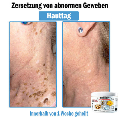 𝐇𝐮𝐝𝐫𝐨𝐬®🥥🏆 𝑩𝒊𝒆𝒏𝒆𝒏 𝑮𝒊𝒇𝒕 𝑴𝒖𝒍𝒕𝒊𝒔𝒚𝒎𝒑𝒕𝒐𝒎 𝑩𝒆𝒉𝒂𝒏𝒅𝒍𝒖𝒏𝒈𝒔𝒄𝒓𝒆𝒎𝒆 (𝐨𝐟𝐟𝐢𝐳𝐢𝐞𝐥𝐥 𝐳𝐞𝐫𝐭𝐢𝐟𝐢𝐳𝐢𝐞𝐫𝐭)