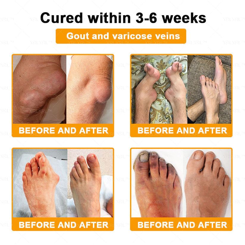 🎄🎄XRLXRL® Bee Venom Pain-Relief Bone Healing Cream (Specially for older adults)