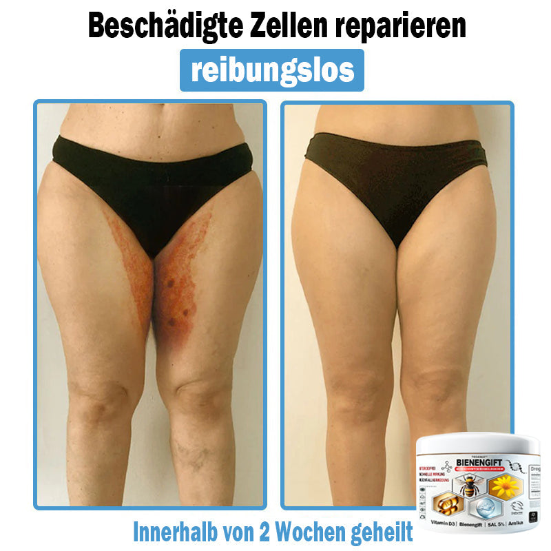 𝐇𝐮𝐝𝐫𝐨𝐬®🥥🏆 𝑩𝒊𝒆𝒏𝒆𝒏 𝑮𝒊𝒇𝒕 𝑴𝒖𝒍𝒕𝒊𝒔𝒚𝒎𝒑𝒕𝒐𝒎 𝑩𝒆𝒉𝒂𝒏𝒅𝒍𝒖𝒏𝒈𝒔𝒄𝒓𝒆𝒎𝒆 (𝐨𝐟𝐟𝐢𝐳𝐢𝐞𝐥𝐥 𝐳𝐞𝐫𝐭𝐢𝐟𝐢𝐳𝐢𝐞𝐫𝐭)