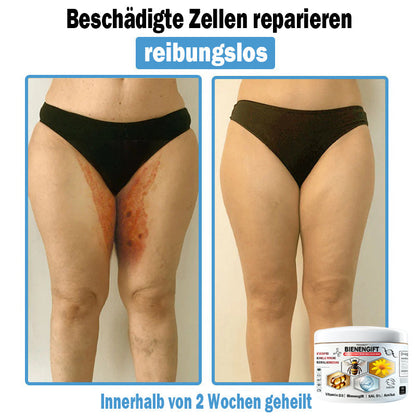 𝐇𝐮𝐝𝐫𝐨𝐬®🥥🏆 𝑩𝒊𝒆𝒏𝒆𝒏 𝑮𝒊𝒇𝒕 𝑴𝒖𝒍𝒕𝒊𝒔𝒚𝒎𝒑𝒕𝒐𝒎 𝑩𝒆𝒉𝒂𝒏𝒅𝒍𝒖𝒏𝒈𝒔𝒄𝒓𝒆𝒎𝒆 (𝐨𝐟𝐟𝐢𝐳𝐢𝐞𝐥𝐥 𝐳𝐞𝐫𝐭𝐢𝐟𝐢𝐳𝐢𝐞𝐫𝐭)