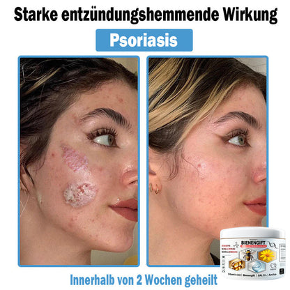 𝐇𝐮𝐝𝐫𝐨𝐬®🥥🏆 𝑩𝒊𝒆𝒏𝒆𝒏 𝑮𝒊𝒇𝒕 𝑴𝒖𝒍𝒕𝒊𝒔𝒚𝒎𝒑𝒕𝒐𝒎 𝑩𝒆𝒉𝒂𝒏𝒅𝒍𝒖𝒏𝒈𝒔𝒄𝒓𝒆𝒎𝒆 (𝐨𝐟𝐟𝐢𝐳𝐢𝐞𝐥𝐥 𝐳𝐞𝐫𝐭𝐢𝐟𝐢𝐳𝐢𝐞𝐫𝐭)