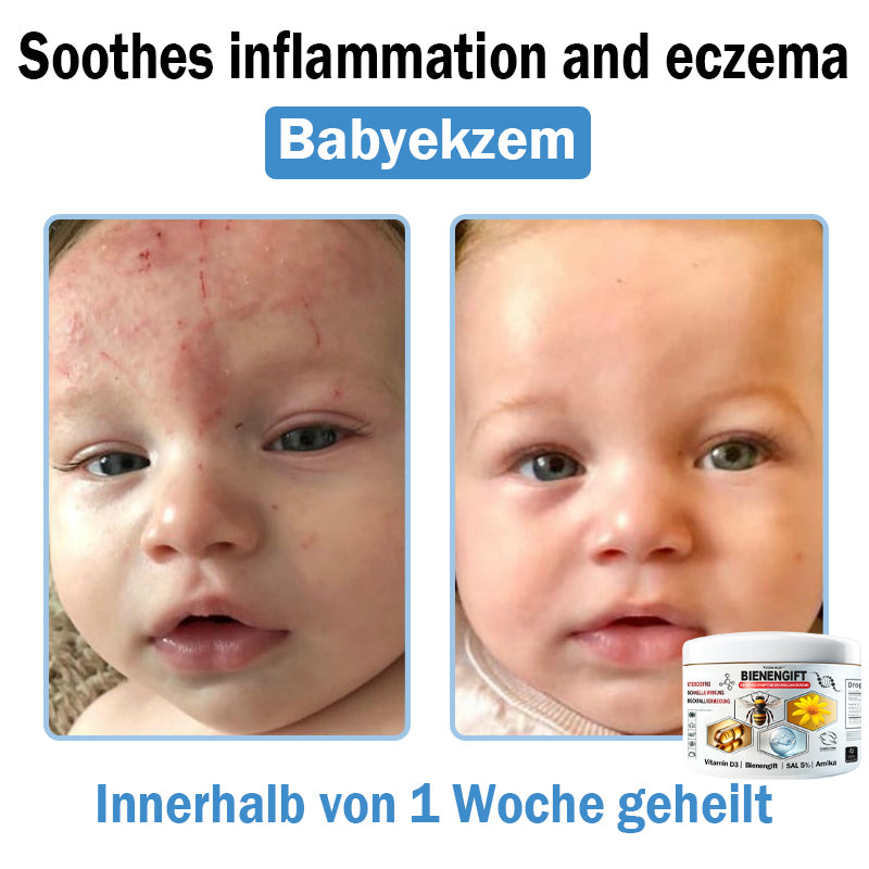 𝐇𝐮𝐝𝐫𝐨𝐬®🥥🏆 𝑩𝒊𝒆𝒏𝒆𝒏 𝑮𝒊𝒇𝒕 𝑴𝒖𝒍𝒕𝒊𝒔𝒚𝒎𝒑𝒕𝒐𝒎 𝑩𝒆𝒉𝒂𝒏𝒅𝒍𝒖𝒏𝒈𝒔𝒄𝒓𝒆𝒎𝒆 (𝐨𝐟𝐟𝐢𝐳𝐢𝐞𝐥𝐥 𝐳𝐞𝐫𝐭𝐢𝐟𝐢𝐳𝐢𝐞𝐫𝐭)