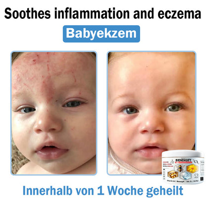 𝐇𝐮𝐝𝐫𝐨𝐬®🥥🏆 𝑩𝒊𝒆𝒏𝒆𝒏 𝑮𝒊𝒇𝒕 𝑴𝒖𝒍𝒕𝒊𝒔𝒚𝒎𝒑𝒕𝒐𝒎 𝑩𝒆𝒉𝒂𝒏𝒅𝒍𝒖𝒏𝒈𝒔𝒄𝒓𝒆𝒎𝒆 (𝐨𝐟𝐟𝐢𝐳𝐢𝐞𝐥𝐥 𝐳𝐞𝐫𝐭𝐢𝐟𝐢𝐳𝐢𝐞𝐫𝐭)